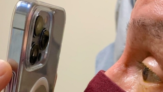 Oftalmólogo usa la cámara del iPhone 13 Pro para evaluar a los pacientes